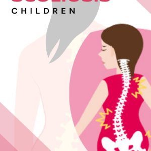 Physiotherapy in Scoliosis in Children